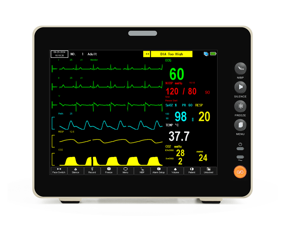 8 インチのタッチスクリーン + EtCO2 ポータブル患者モニター - ECG
